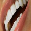 تجميل الأسنان لا يجعلها جذابة وناصعة البياض مثل الصور الدعائية