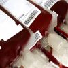 تشميع معمل تحاليل في الشرقية يبيع أكياس دم مجهولة المصدر