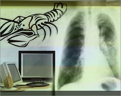 تجربة علاج كيميائي لسرطان الرئة تظهر إمكانات واعدة