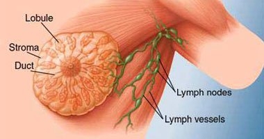 دراسة: مريضات السرطان يفضلن إعادة بناء الثدى بالأنسجة الخاصة بهن 
