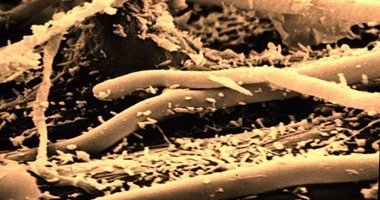 دراسة أمريكية جديدة تكشف عن استخدام "بكتيريا التربة" فى علاج السرطان