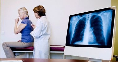 تعرف على أسباب وأعراض مرض العملقة "جوشر" 