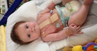 باحثون : فيروس معوى غامض يصيب الأطفال الأمريكيين 